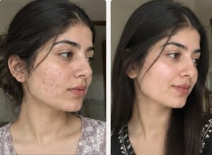 Kappa Radiance Glow Triple Action Brightening Face Wash – Kojic Acid, Niacinamide & Glutathione | Micro-Bead Exfoliating Deep Cleansing Facial Cleanser | 100ml chatgpt image sep 30, 2026, 11 08 27 pm 1